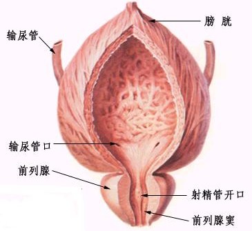 无菌性前列腺引发　“冤情”