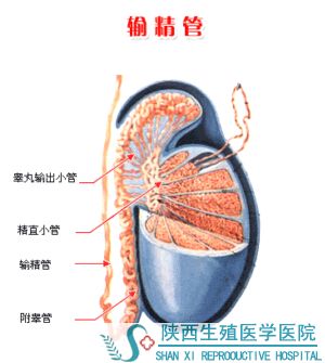 输精管堵塞的原因是什么