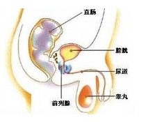 男性尿路感染预防方法
