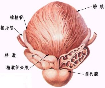 前列腺增生的八大类型