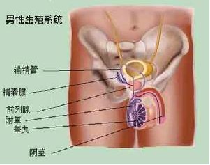 精囊炎典型的症状有哪些呢