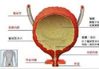 膀胱炎的图片