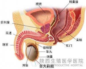 前列腺炎钙化怎么回事