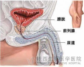 细菌性前列腺炎的症状是什么